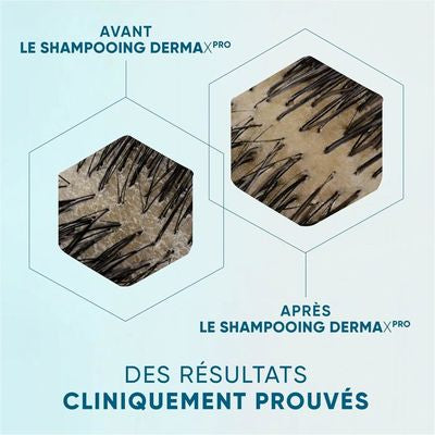 Head & Shoulders Head& شامبو ديرما اكس برو لتهدئة فروة الرأس