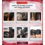 Bioxcin شامبو تساقط الشعر المكثف - للنساء والرجال
