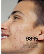 Touché Sérum Acide Salicylique 10% Anti-Imperfections